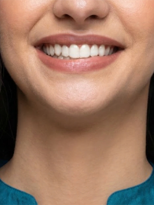 Woman holding orange slice, representing tooth enamel protection